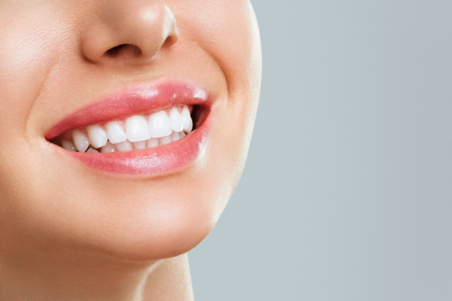 Tratamientos de estética dental para mejorar tu sonrisa y la apariencia de tus dientes