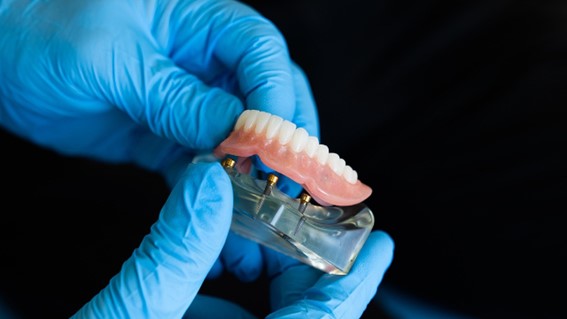 Cuidados necesarios para una prótesis dental 