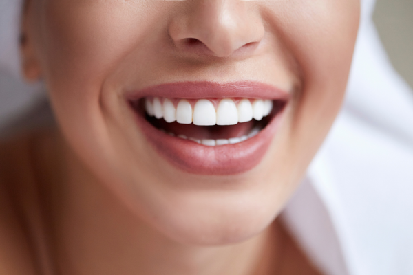¿Qué es el blanqueamiento dental y cómo te ayuda a mejorar tu sonrisa?
